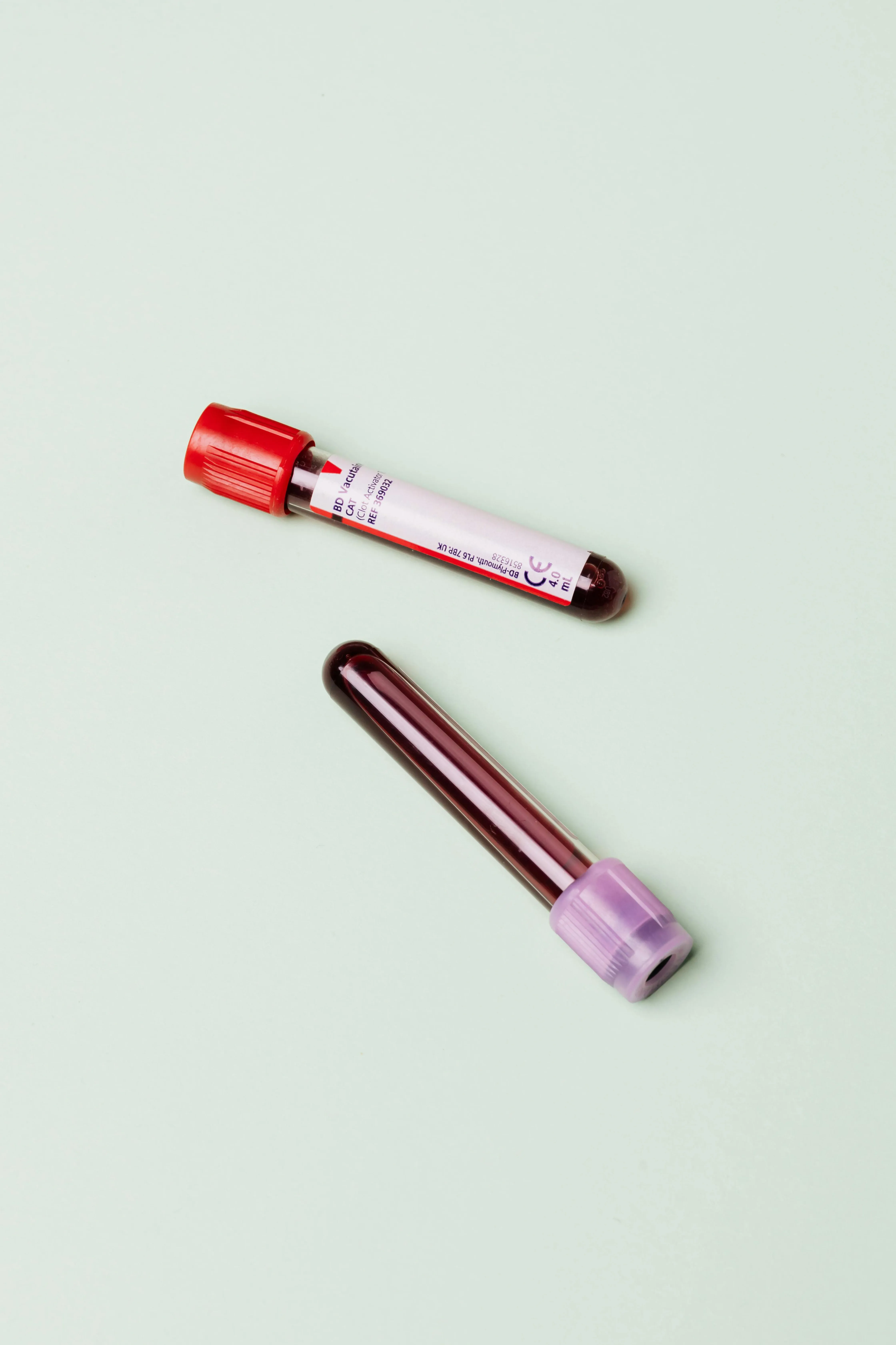 Laboratorio transfusional de Hemolife analizando muestras de sangre